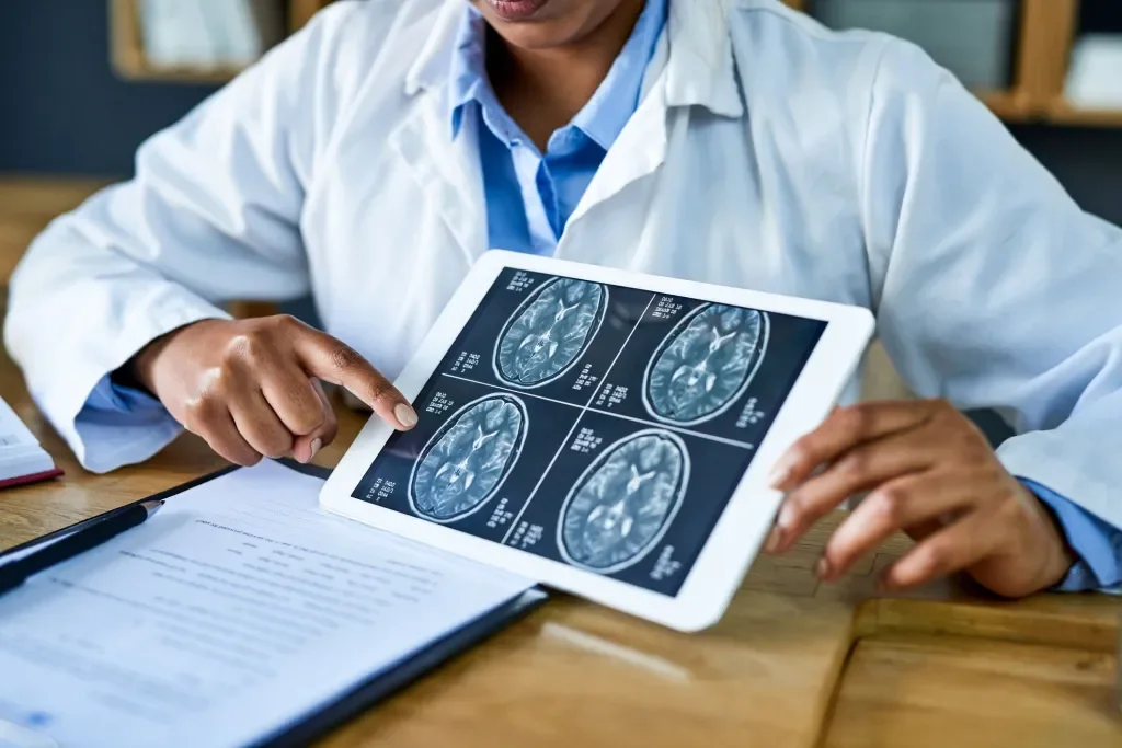 Imagens avançadas podem tornar radioterapia cerebral mais precisa