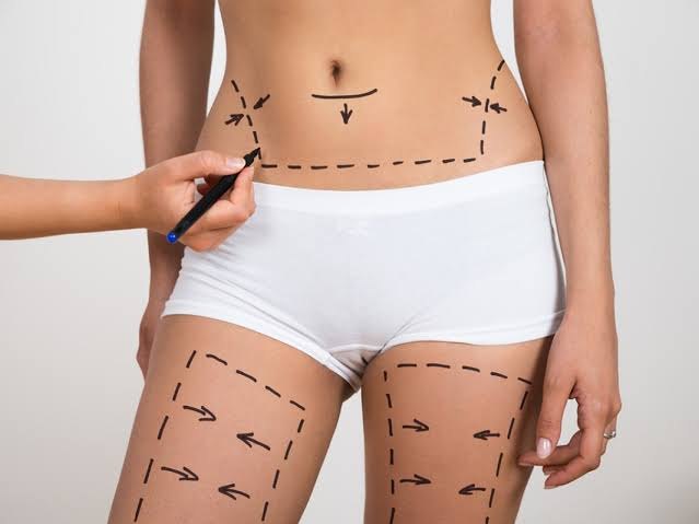 Duas mulheres morreram após cirurgias em clínica de Miami, aponta investigação