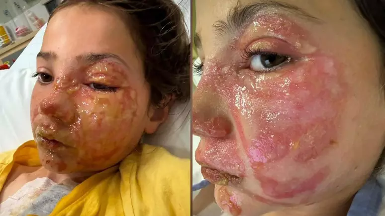 Desafio do brinquedo no micro-ondas: Tendência do TikTok deixa menina ferida